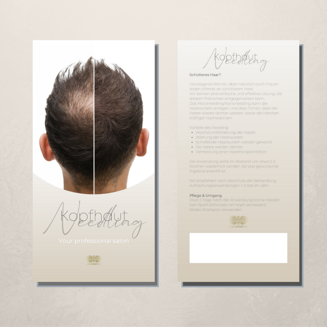 Flyer Kopfhaut Needling Pflegehinweise DIN A6 50 Stück für Kosmetikstudios CFB Cosmetics®