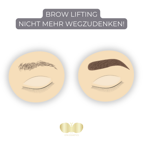 Brow Lifting – A Well-Established Trend for Perfect Eyebrows