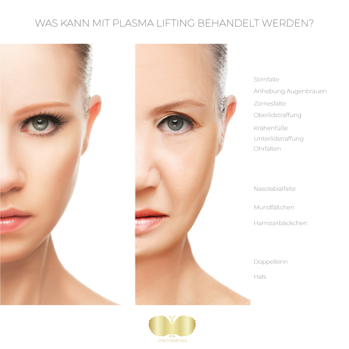 PlasCom® Plasma Pen Device for Skin Tightening & Rejuvenation CFB Cosmetics®