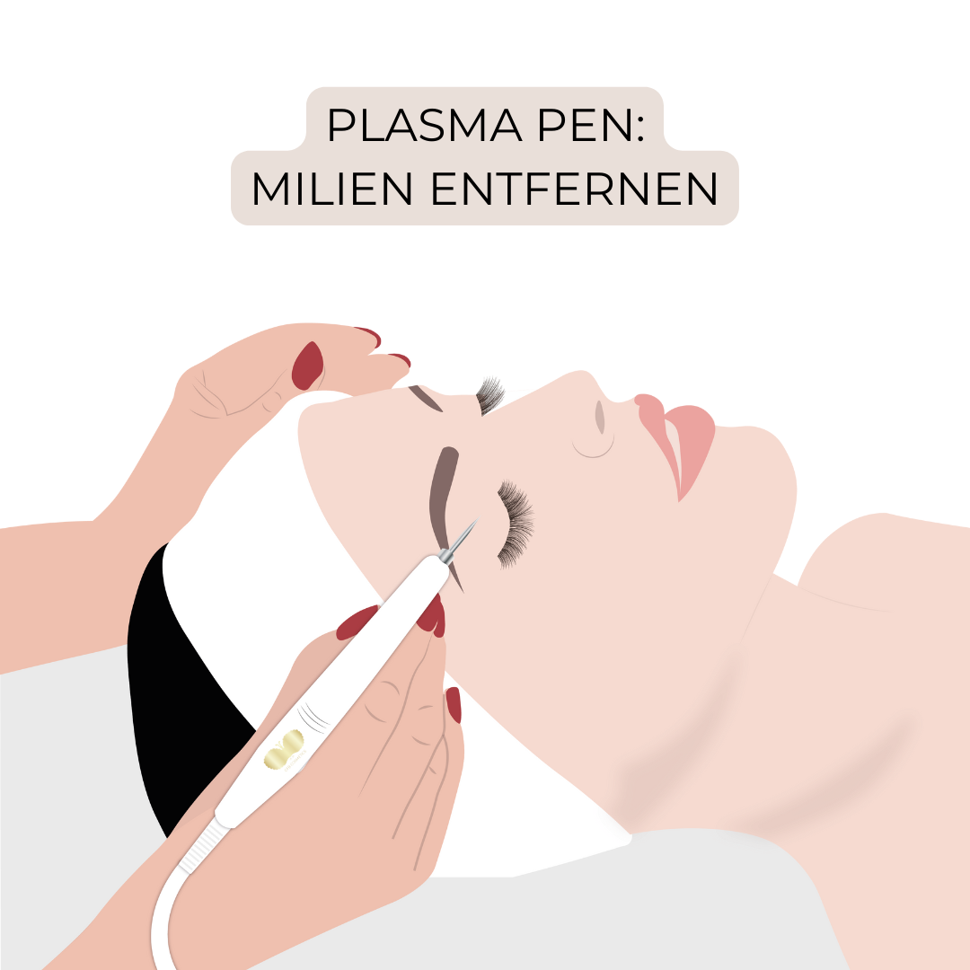 Plasma Pen: Milien entfernen
